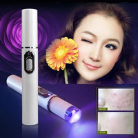 Blue Light Therapy Acne Laser Pen Soft Scar Wrinkle Removal Treatment Device Skin Care Beauty Equipment - 7DAY'S