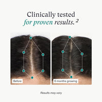 Nutrafol Women's Hair Growth Supplements, Ages 18 - 44, Clinically Proven for Visibly Thicker and Stronger Hair, Dermatologist Recommended - 1 Month Supply - 7DAY'S